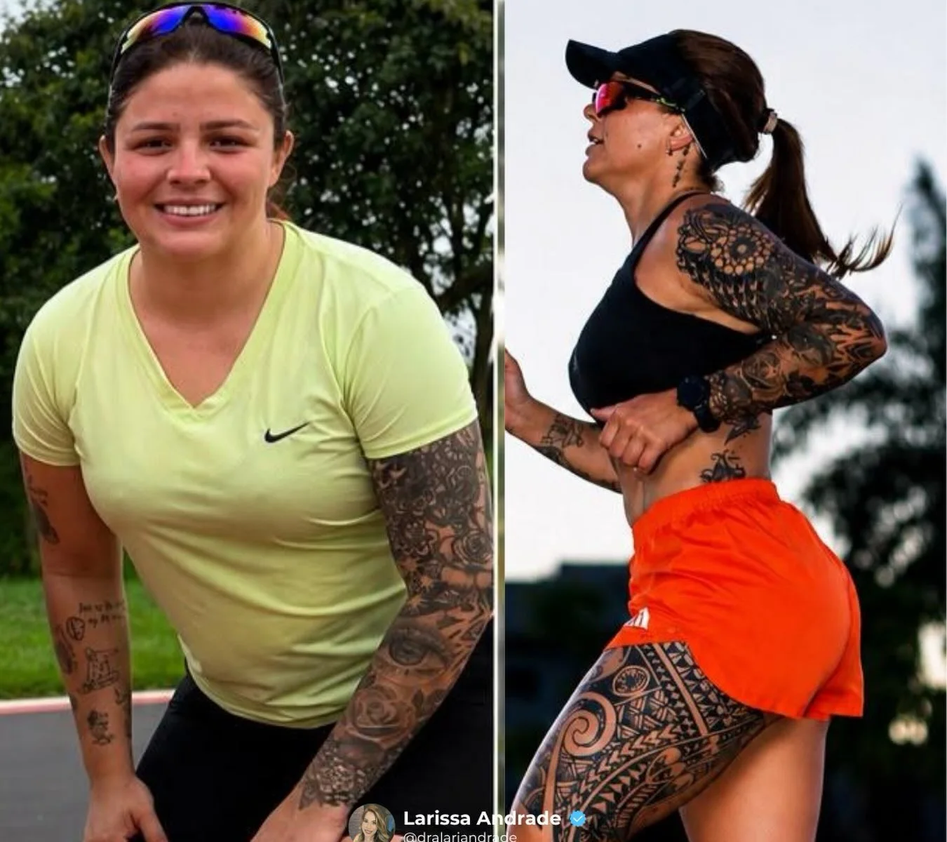 Duas fotografias corporais lado a lado publicadas no perfil da Dra. Larissa Andrade